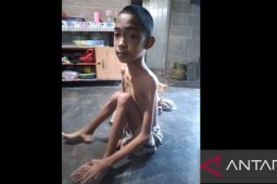 Pelajar SLB Bangka alami masalah di tulang ekor