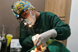 Trend hidung mancung dengan prosedur Rhinoplasty