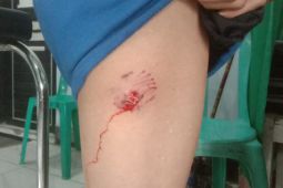 Waduh, tiga anak digigit anjing diduga rabies di Dompu NTB