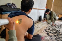 Program hapus tato gratis di Bandung