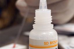 Dokter bilang tes HIV tak menyakitkan