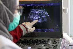 Pria sebaiknya tidak konsumsi alkohol tiga bulan sebelum rencana hamil