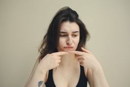 Rekomendasi perawatan kulit berjerawat dari dermatologis