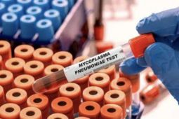 Indonesians urged to mask up after pneumonia cases emerge in jakarta