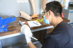 RSUD Kota Tangerang sediakan layanan alat bantu kaki bengkok
