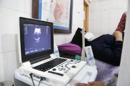 Dinkes imbau masyarakat manfaatkan USG dua dimensi gratis di puskesmas