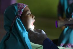 Bernapas lewat mulut pengaruhi pertumbuhan gigi dan wajah anak