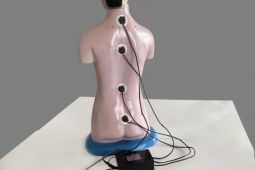 Tim mahasiswa Itera kembangkan alat deteksi kelainan tulang belakang