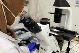 Mahasiswa UGM mengeksplorasi "superfood" pencegah stunting dari mikroalga