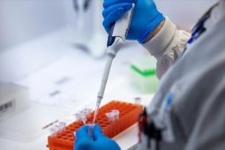 UNICEF ajukan 16,5 juta dolar AS untuk tangani mpox di Afrika