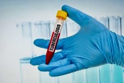 Jepang wajibkan tes TBC untuk WNA yang akan tinggal lebih dari 3 bulan