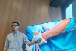 Pemilihan sepatu jadi faktor utama mencegah cidera kaki