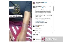 Polisi selidiki video viral kasus dugaan penganiayaan terhadap ART asal Banyumas