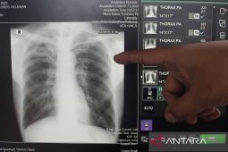 Jakbar catat 2.189 kasus TBC sejak awal 2025
