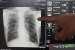 Dinkes Kabupaten Tangerang bentuk desa bebas TBC