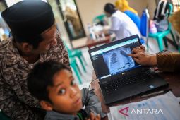 Pencegahan TBC pada anak melalui pembatasan kontak