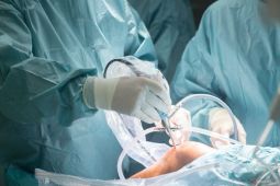 Arthroscopy: solusi bedah minimal invasif untuk masalah sendi