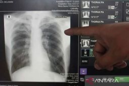Dinkes Bandarlampung gunakan X-ray untuk deteksi pasien TBC