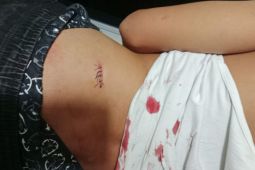 Siswa SMA di Lombok Timur aniaya teman sekolah pakai sajam