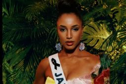 Miss Jamaica terjatuh dari panggung hingga alami pendarahan dan cedera