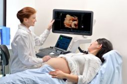 Hari Ibu, POGI gaungkan pentingnya deteksi dini kehamilan dengan teknologi Mindray