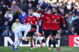 Manchester United berbagi poin dengan Burnley usai ditahan imbang 2-2