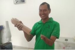 Yayasan disabilitas di Bali mulai produksi tangan palsu per Januari
