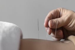 Dokter: Akupuntur wajah membuat kulit tampak lebih cerah dan segar