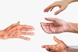 Dinkes P2KB Provinsi ungkap situasi kusta di Gorontalo