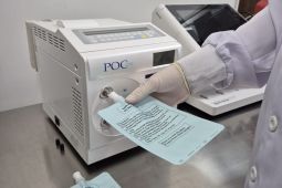 Pendekatan UBT bantu deteksi dini bakteri infeksi H.pylori di yang berkoloni lambung