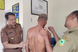 Mengikis stigma untuk eliminasi penyakit terabaikan bernama kusta