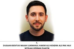 Bareskrim Polri ajukan penerbitan "red notice" terhadap penyuplai sabu "The Doctor"