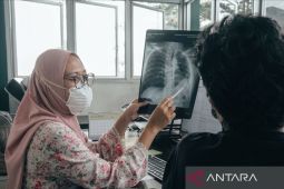 Paparan asap karhutla jangka panjang berisiko turunkan fungsi paru