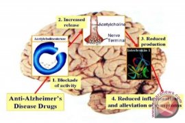 Tahu Tempe Cegah Penurunan Daya Ingat