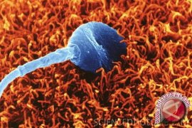 Kota Besar Penyebab Turunnya Kualitas Sperma