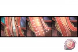 Terapi Stretta&Atilde;&sbquo;&Acirc;&reg; untuk GERD Memperoleh Rekomendasi Terkuat dalam Pedoman Klinis Baru SAGES