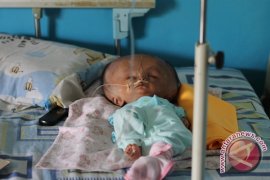 Penderita Hanya Minum Susu 