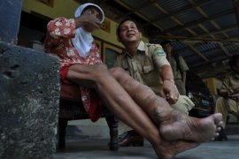 Penderita penyakit kaki gajah didekteksi Dinkes Mukomuko