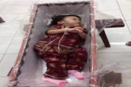 Sasa Bayi Dempet Asal Landak Meninggal Dunia