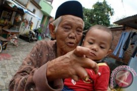 Kalbar tangani 89 penderita kusta sepanjang 2018