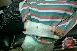 Nisam Bacok Tangan Istri Akibat Cemburu