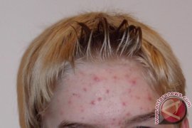 Ini Alasan Kenapa Cowok Perlu Scrubbing Wajah