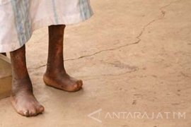 Dinkes Tulungagung Temukan 20 Penderita Lepra Baru