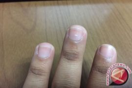 Arti tanda putih di kuku 