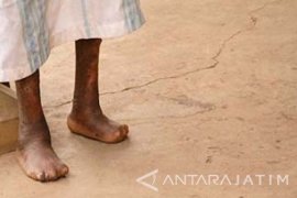 Pamekasan Tekan Penderita Kusta dengan "Pelita"