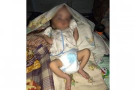 KNPI Barito Utara Galang Dana untuk Bayi Hidrosefalus 