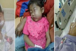 Bocah Pengidap Lipoma Harapkan Bantuan Pemerintah