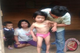 Bocah di Tebo penderita jantung bocor butuh dermawan 