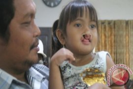 Antam Gelar Operasi Bibir Sumbing 