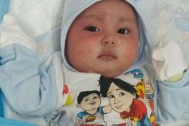 Pemprov Riau Tanggung Biaya Pengobatan Al-Hafizi, Bayi Berpenyakit Langka